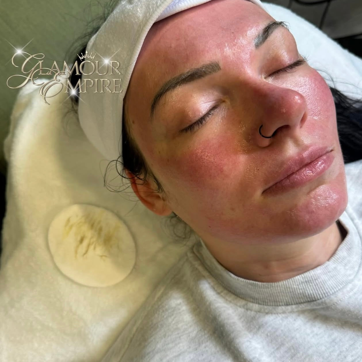 Facials